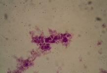 日本爆發「食人菌」疫情 近千人感染 (圖/示意圖)