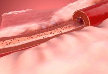 營養師揭示:5種隱藏高鈉食物 包括「1種麵類 (圖/示意圖)