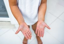 腸病毒仍處流行期 留意個人衛生 (圖/示意圖)