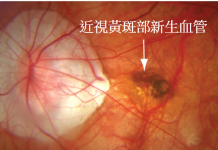視界雲霧再現? 成年後近視度數居然逆襲眼睛健康何去何從? 圖/台北市政府提供