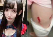 「流浪狗襲擊事件」日女偶像驚曝:差點喪命! (圖/取自彩瀨千聖推特)