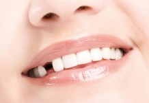 缺牙怎麼辦?好假牙讓你沒煩惱!