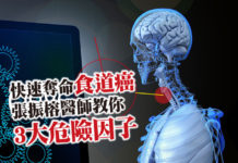 快速奪命食道癌 張振榕醫師教你3大危險因子