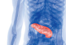 胰臟癌8成致死率 張振榕醫師揭祕辛