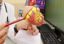 心肌梗塞年輕化 統計指出原因