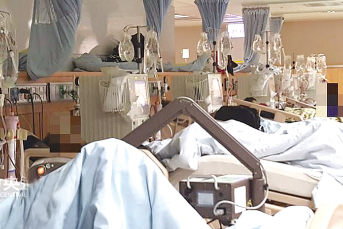 洗腎病患罹患眼疾  風險比常人高數倍