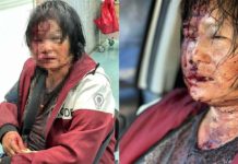 2屁孩狂毆資源回收阿嬤 超商打工兒子心碎報案