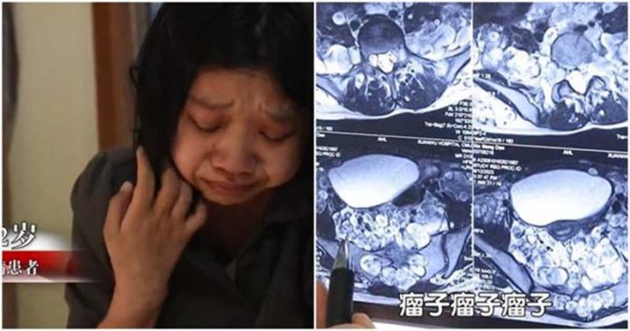 圖為丹丹身體上佈滿大大小小腫瘤，醫師說，丹丹可能「隨時都感到痛」。圖／取材北京衛視