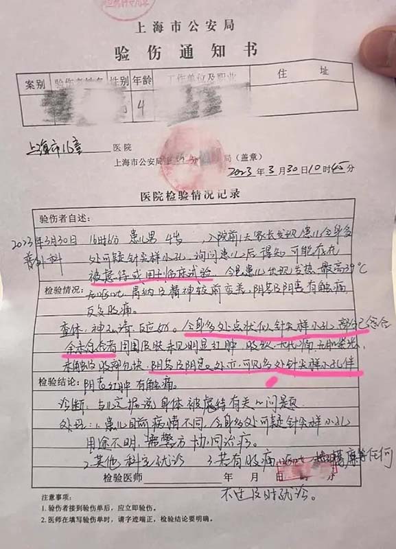 上海幼稚園疑似孩童家長在網上爆料虐童案，家長po出驗傷單顯示多處淤青，且有針孔，疑似被注射。圖／引自大皖新聞網