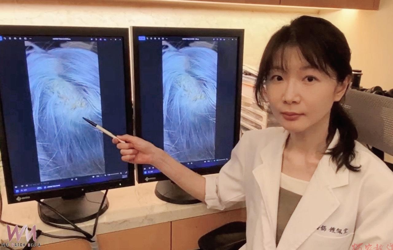 頭皮不適別輕忽 20歲女染淺灰後潰爛掉髮 醫提醒:漂髮風險 頭皮不適別輕忽 20歲女染淺灰後潰爛掉髮 醫提醒:漂髮風險