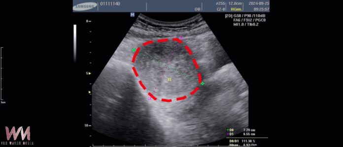 20260109185655_0_f1d361