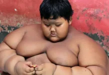 胖妹胖弟看過來!醫師教你逆轉代謝症候群 過5成圓圓有改善 圖/翻攝自太陽報