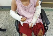 越南女遭同鄉拐騙上車 囚禁、電擊、毆打逼贖款 被害女子遭電擊及暴力施虐,遍體鱗傷。(圖 / 記者張凱鈞翻攝)